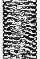 Medulla: Wide aeriform lattice (magnification 468x)