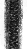 Primary guard hair medulla: Narrow aeriform lattice (magnification 468x)