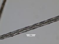 Guard hair scales, proximal half of hair: Diamond petal