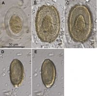 Parasite eggs from moa coprolites