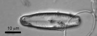 <em>Pinnularia barberiana</em>; image by Cathy Kilroy (NIWA)