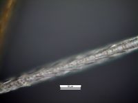 Scales proximal half of hair: Diamond petal