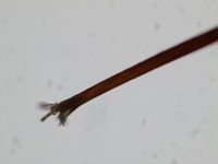 Fig. 16. Typical example of the frayed appearance of a damaged hair endtip