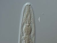 Hemicriconemoides cocophilus female pharyngeal region