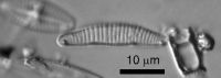 <em>Eunotia sudetica</em> var. <em>hamuraensis</em>; image by Cathy Kilroy (NIWA)