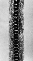 Smaller guard hair medulla: Uniserial ladder (magnification 468x)