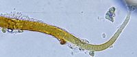 Figure 1. Ammatoidea normanii, a cyanobacteria known from both Antarctica and the New Zealand alpine zone. Image - Phil Novis