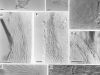 Microscope images of <em>Torrendiella cannibalensis</em>.