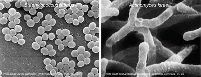 Figure 1. Examples of the structure of bacteria.