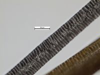 Medulla, adult hair: Wide aeriform lattice
