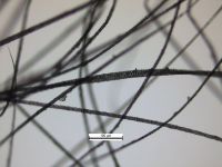 Medulla, adult hair, showing range of hair sizes: Wide aeriform lattice