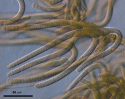 New Zealand cyanobacterium (Pseudoscytonema alpina). Image - Phil Novis 