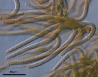 New Zealand cyanobacterium (<em>Pseudoscytonema alpina</em>). Image - Phil Novis 