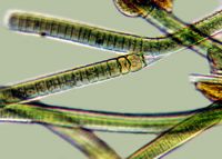 <strong><em>Tolypothrix</em>, Lake Hayes, X640</strong> Photo: Otago Regional Council & Landcare Research