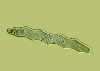 <strong><em>Eunotia sepentina</em>, north Taranaki, X400</strong> Photo: Taranaki Regional Council & Landcare Research