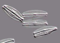 <strong><em>Craticula molestiformis</em>, X1000</strong> Photo: Phil Novis, Landcare Research