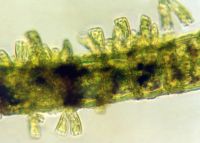 <strong>Rhoicosphenia attached to filamentous alga, X320</strong> Photo: Otago Regional Council & Landcare Research