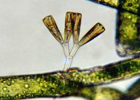 <strong><em>Gomphonema</em> attached to <em>Cladophora</em>, X320</strong> Photo: Otago Regional Council & Landcare Research