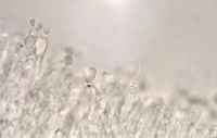 Basidiomata and basidiospores of the crown rot fungus under a microscope