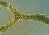 <strong><em>Microcystis</em> (sewage pond), X400</strong> Photo: Landcare Research