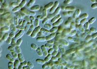 <strong><em>Stichococcus</em>, X1000</strong> Photo: Phil Novis, Landcare Research